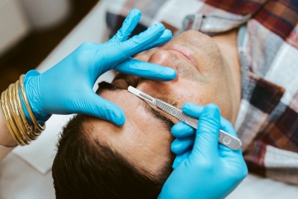 Dermaplaning Treatment Athens GA